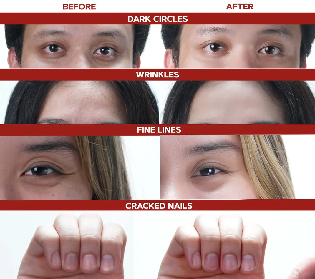 Before and after comparison showing results for dark circles, wrinkles, fine lines, and cracked nails